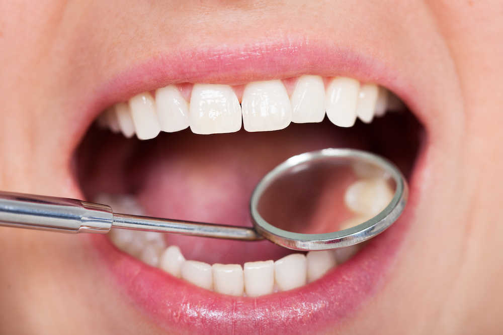8 Tips for Healthy Teeth and Gums